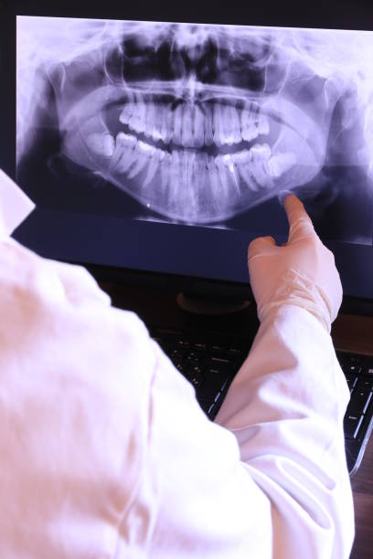 Best Emergency Treatment for Dental Infections or Abscesses in Chilton, WI